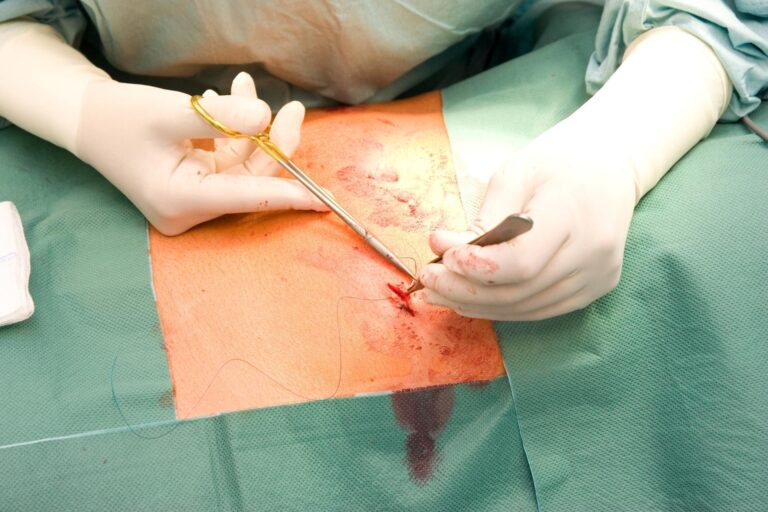 Beitragsbild dermolex Primäre Wundheilung
