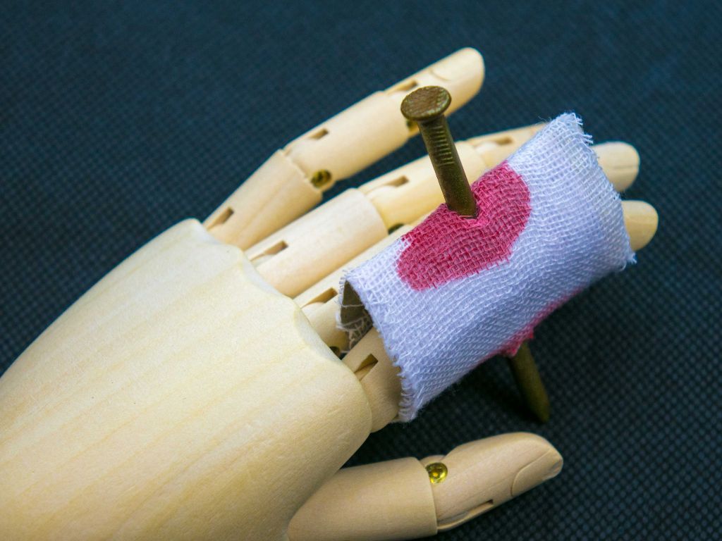 Abbildung einer Hand mit offener Wunde