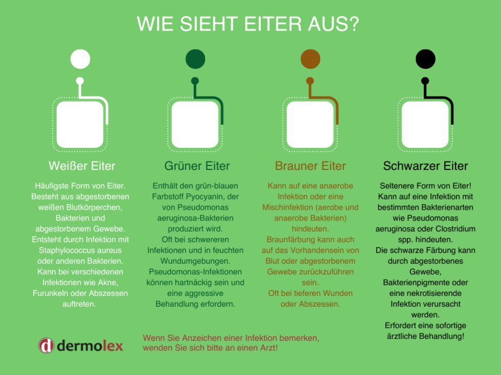 Eiter Aus Wunde Entfernen Oder Nicht dermolex.com